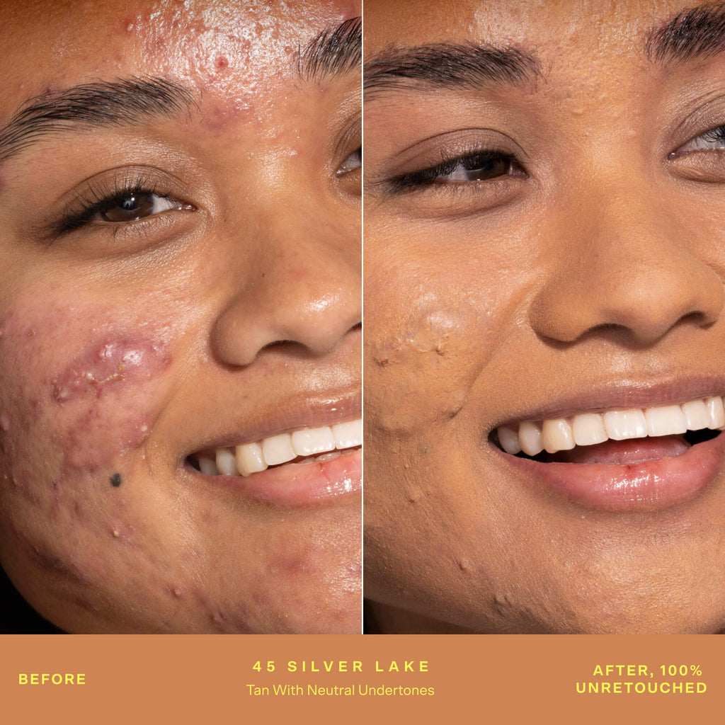 SunnyDays™ Tinted SPF 30 T9