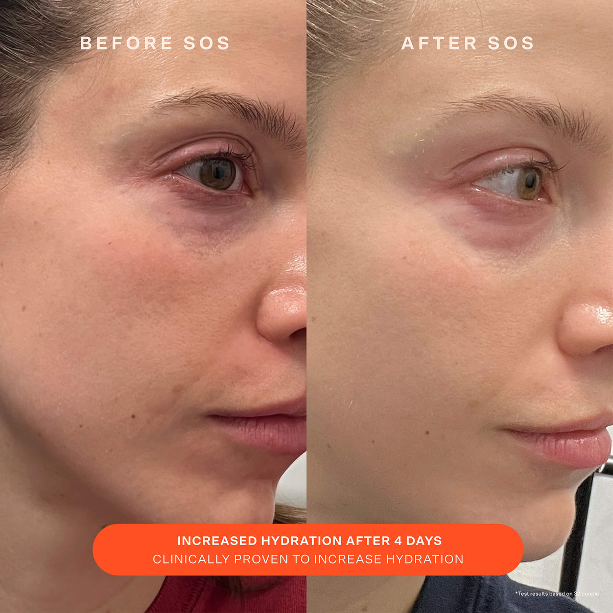 SOS Recovery Cream I0