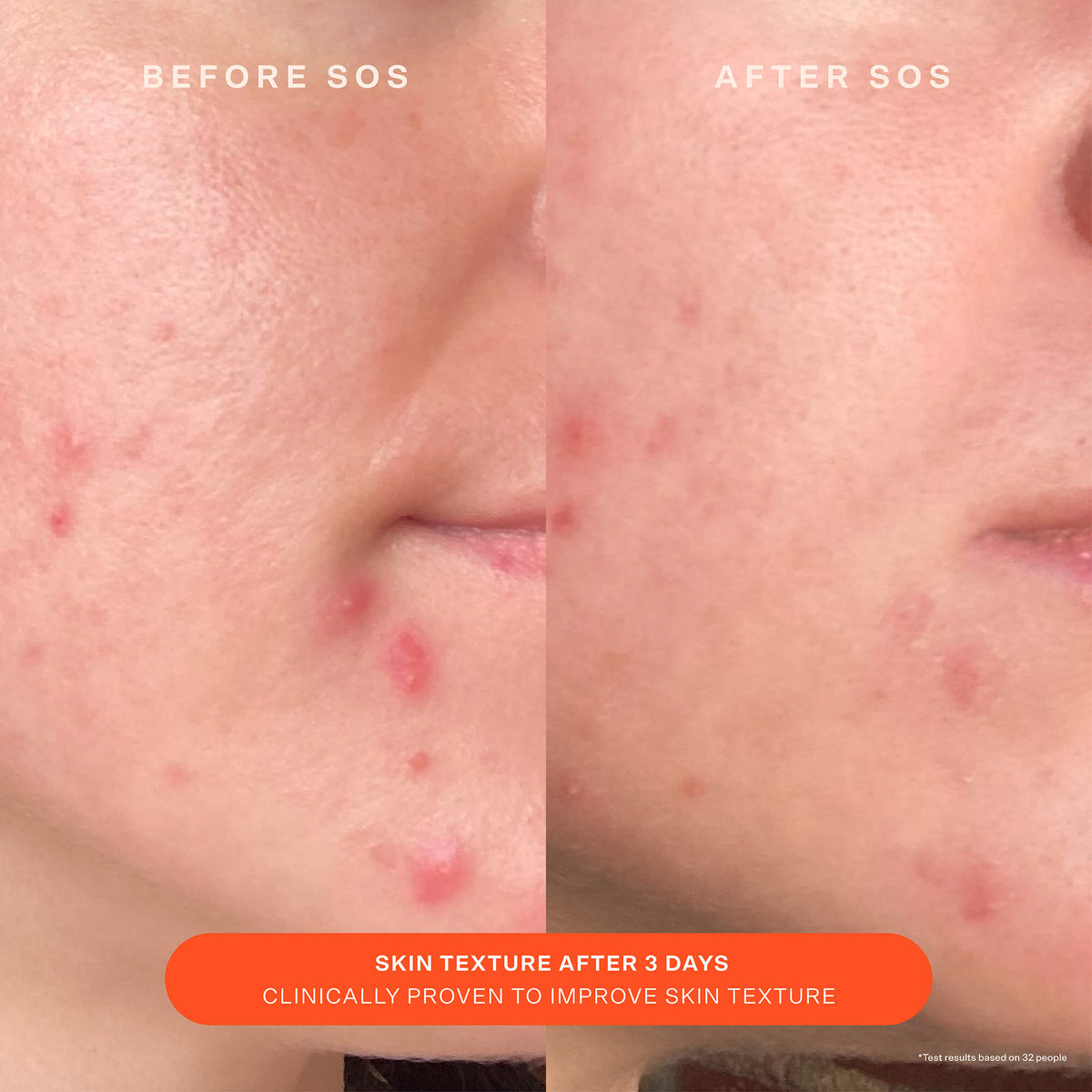 SOS Recovery Cream I0