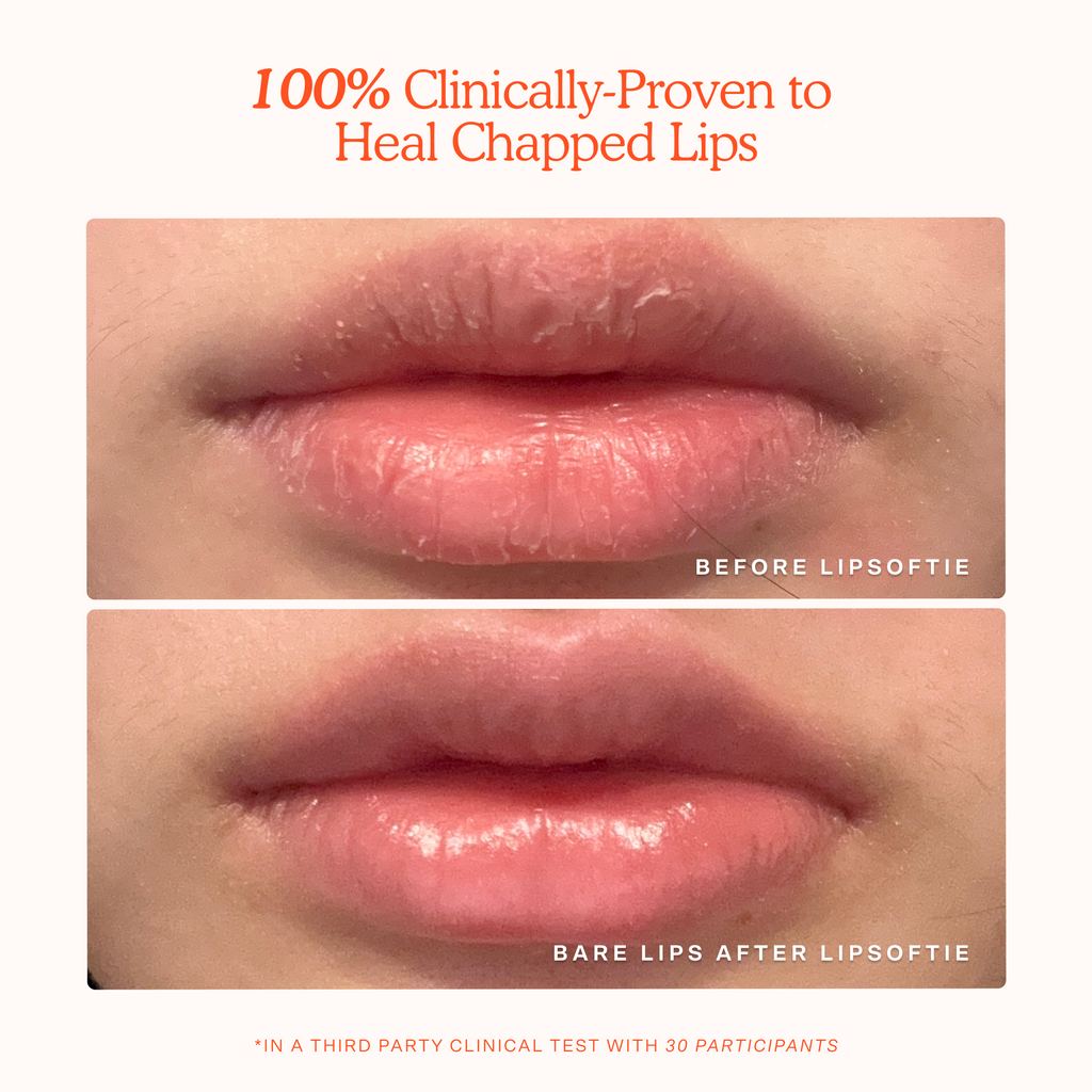 LipSoftie® Lip Treatment O9