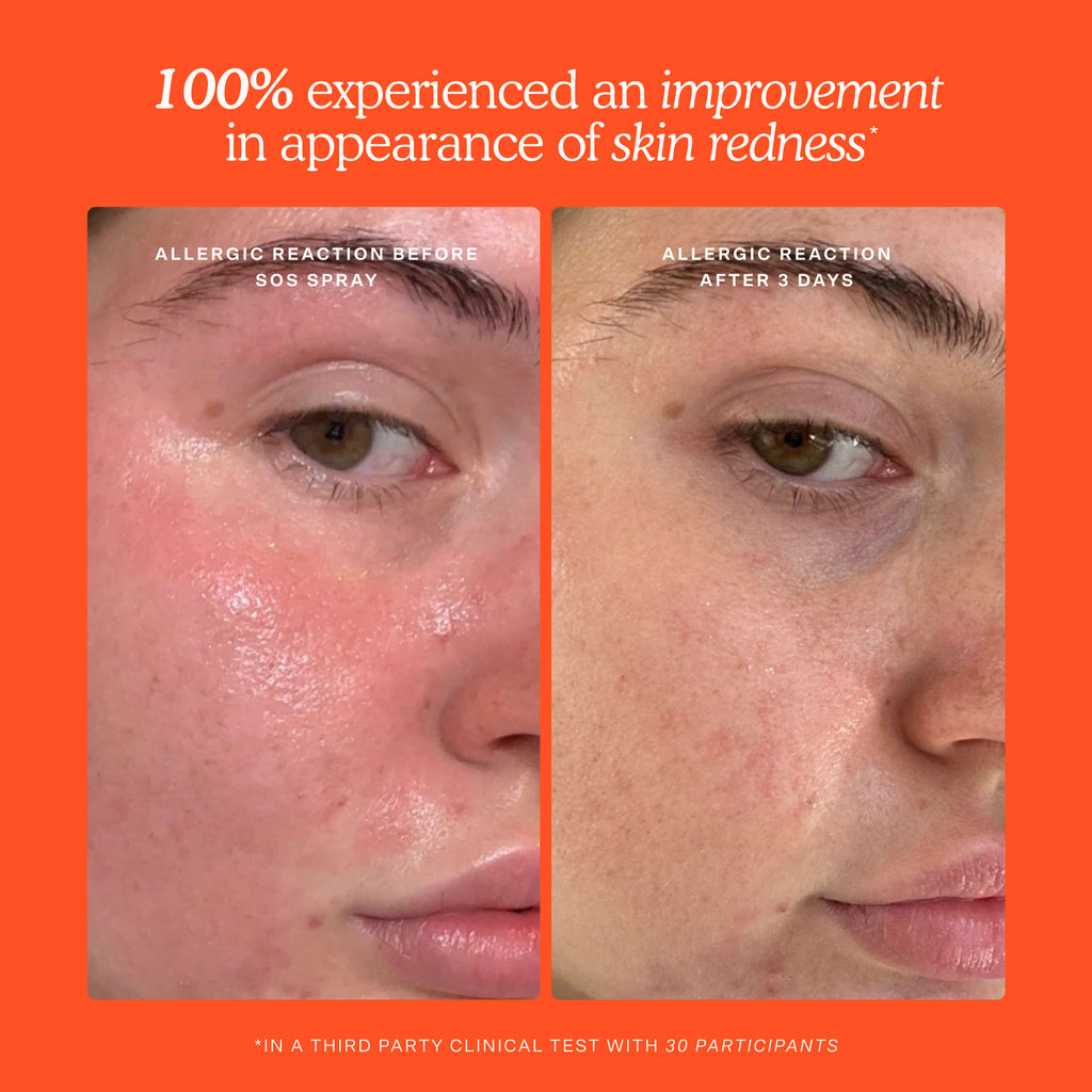 SOS Skincare Minis Kit T6