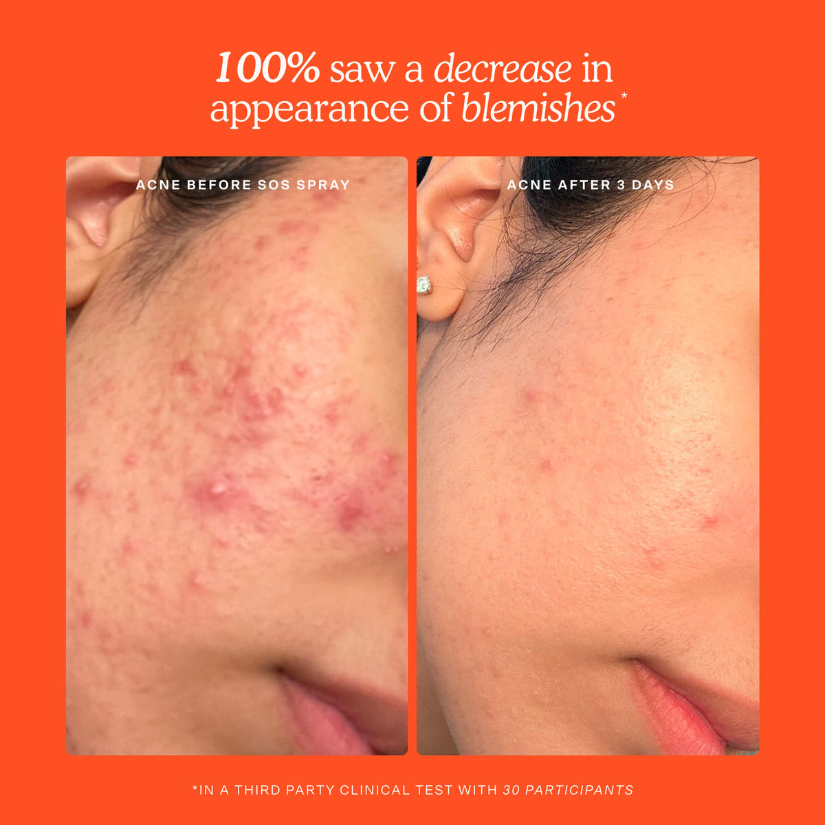 SOS 3-Step Skincare Set A6