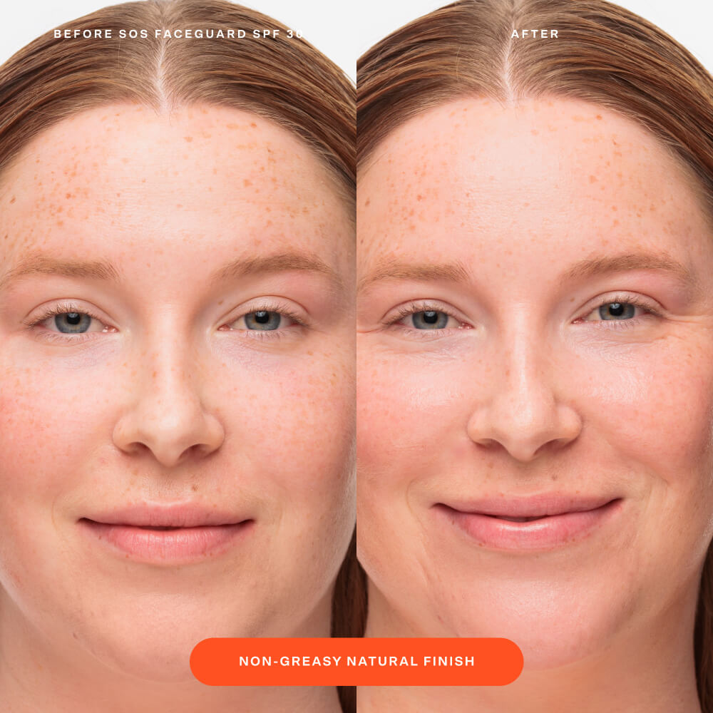 SOS FaceGuard™ SPF 30 Sunscreen PA+++ D9