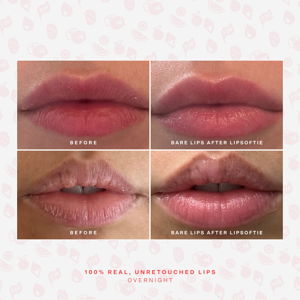 LipSoftie® Lip Treatment Set J0