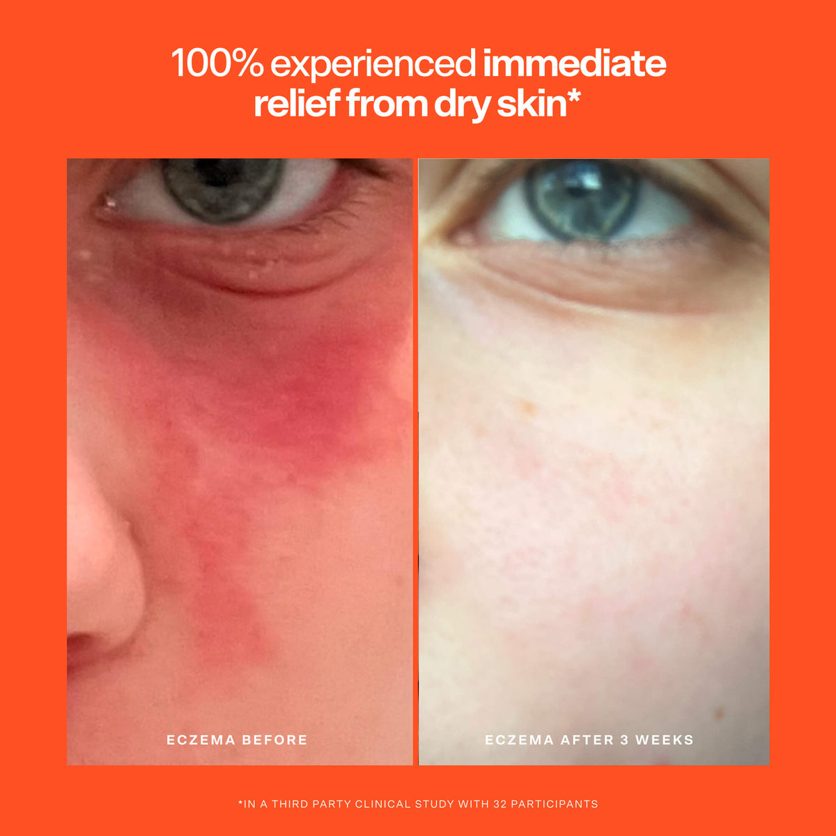 SOS Rescue Serum J7