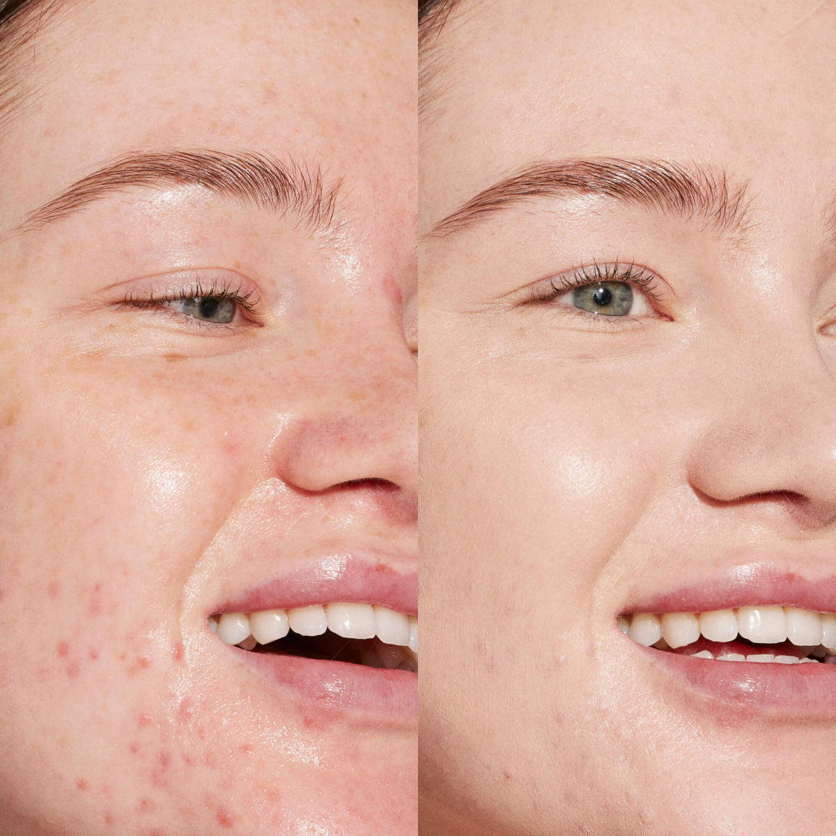 Swipe Serum Concealer® W4